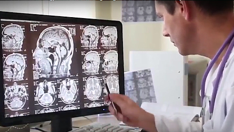 Trí tuệ nhân tạo điều trị ung thư: Lần đầu tiên tại Việt Nam