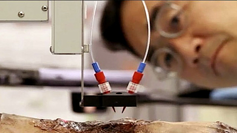 Máy in 3D sinh học in da trực tiếp lên vết thương