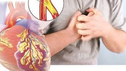 Một số bệnh tim mạch thường gặp do hút thuốc lá