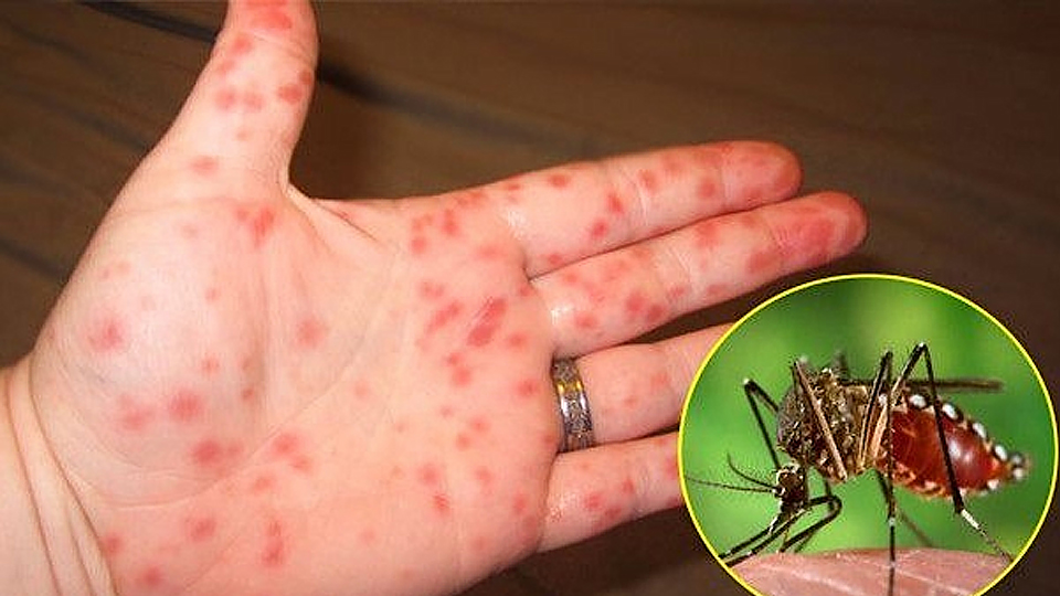 Hà Nội: Xuất hiện hai ổ dịch sốt xuất huyết có nguy cơ bùng phát