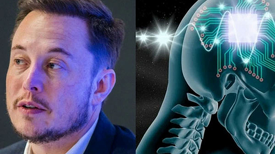 Công ty của Elon Musk chuẩn bị cấy ghép chip vào não người để &quot;chế tạo&quot; siêu nhân