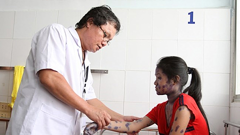 Bác sỹ điều trị cho một bệnh nhân mắc bệnh thủy đậu. (Ảnh: Phương Vy/TTXVN)