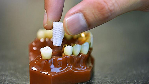 Chân răng 3D được in với chất liệu canxi, giống như kết cấu răng tự nhiên của con người.