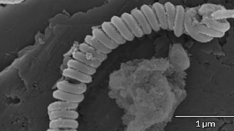 Các nhà khoa học chế tạo ống cuộn siêu nhỏ từ carbon, nitơ và mangan, có khả năng sinh ra phản ứng hóa học làm tan hạt vi nhựa.