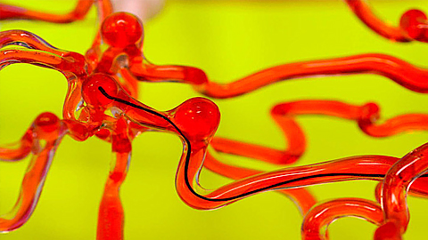 Sợi dây robot di chuyển trong mô hình mạch máu. Ảnh: thetimes.co.uk