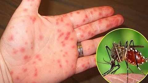 Thời tiết mùa hè thích hợp cho muỗi vằn sinh trưởng, gây bệnh sốt xuất huyết.