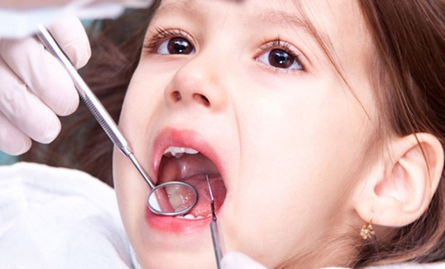 Viêm nha chu ở trẻ do nhiều nguyên nhân, trong đó thường gặp nhất là vệ sinh răng miệng chưa tốt. Ảnh minh hoạ.