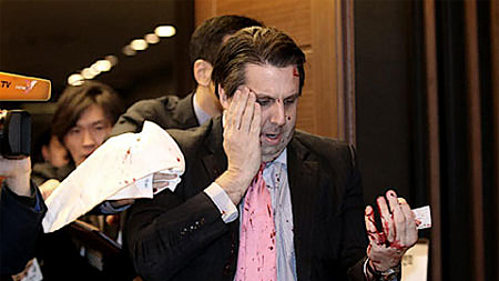 Đại sứ Mỹ tại Hàn Quốc bị tấn công