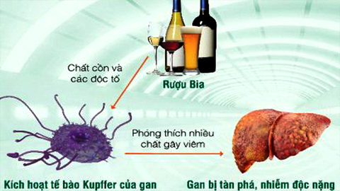 Sẩn ngứa do gan và cách ứng phó