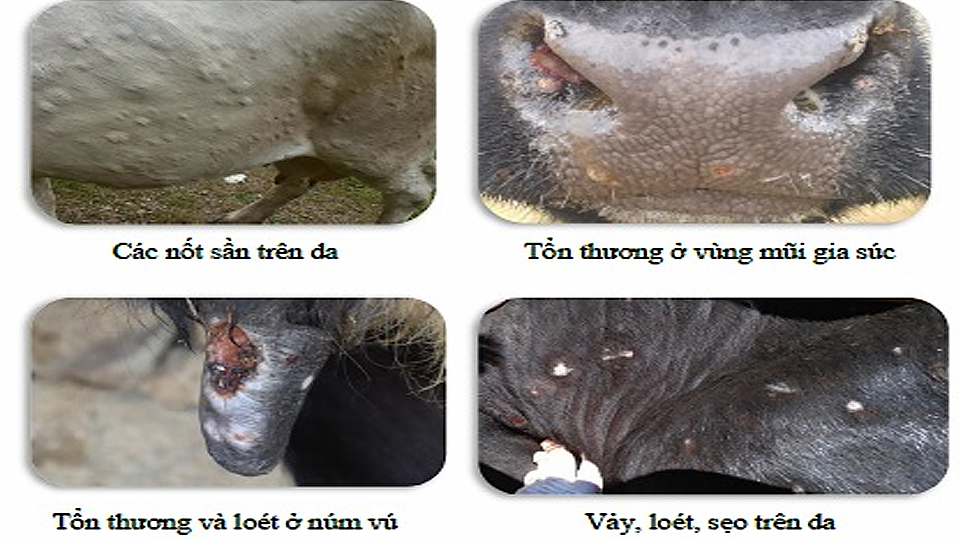 Một số hình ảnh về dấu hiệu của bệnh viêm da nổi cục